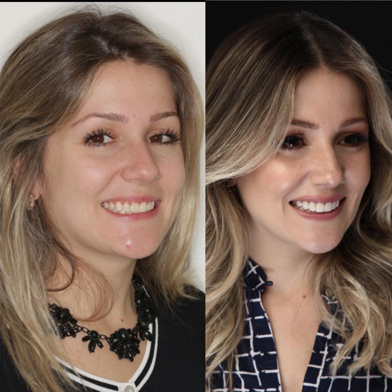 WhatsApp Image 2020-03-12 at 02.24.45 (11)